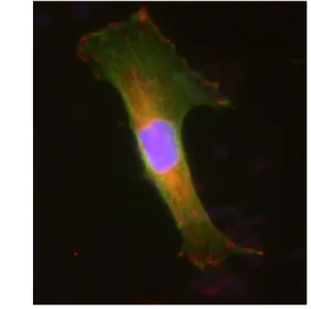 Figure 2: T24 cancer cell spread on a  polyacrylamide substrate (E=10kPa). Green is the  actin cytoskeleton, whereas red represents the focal 