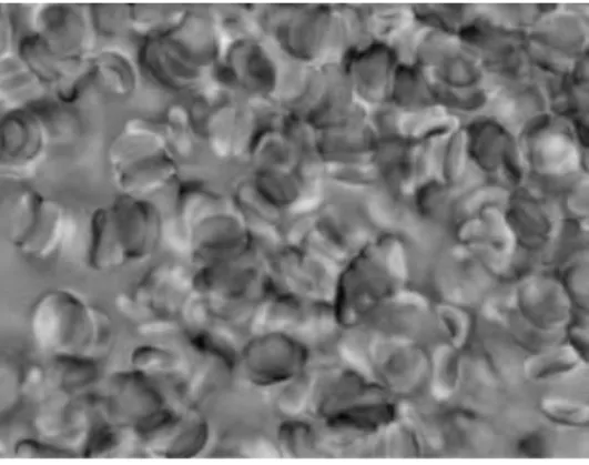 Figure 5: Picture of full blood, including RBCs, White blood cells and plasma.