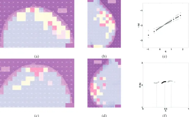 FIGURE 4. Wavelet-based multifractal segmentation of X-ray mammograms. Patient 20: cancerous right breast (a, b) and  contralateral unaffected left breast (c, d)