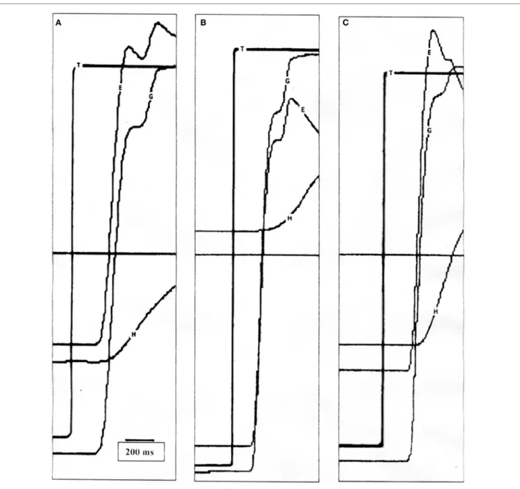 FigUre 2 | (a) Position tracings of a control subject making a 50° saccade with typical head movement