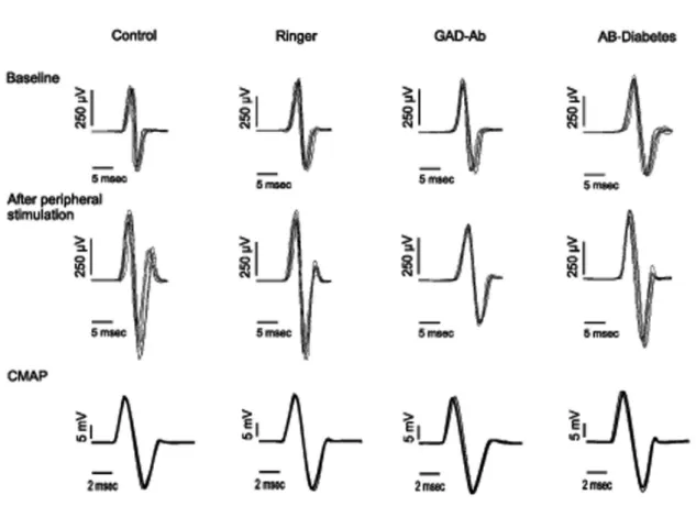 Figure 1A. Modulation of the excitability of the right motor cortex following repetitive somatosensory stimulation of left sciatic nerve