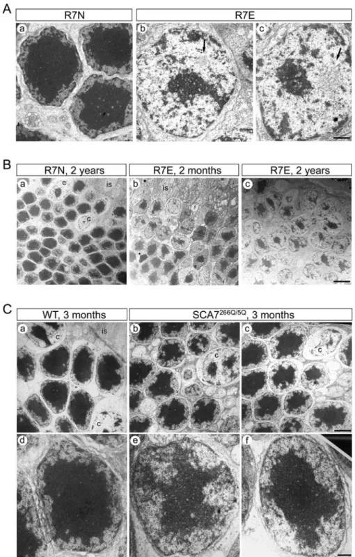 Figure 1. Severe Reorganization of Chromatin Territories in Rod Photoreceptors from SCA7 Mice