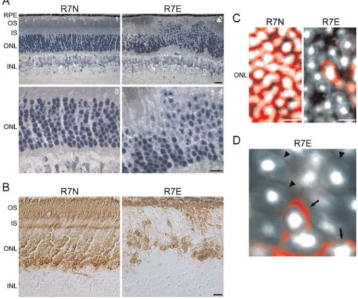 Figure 2. Chromatin Remodeling in Rod Nuclei Paralleled Segment Loss and Rho Down-Regulation in SCA7 Mice