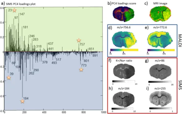 Figure 5.  MRI, SIMS and MALDI images revealing the distribution of the infarct core in wild-type mice after  transient middle cerebral artery occlusion