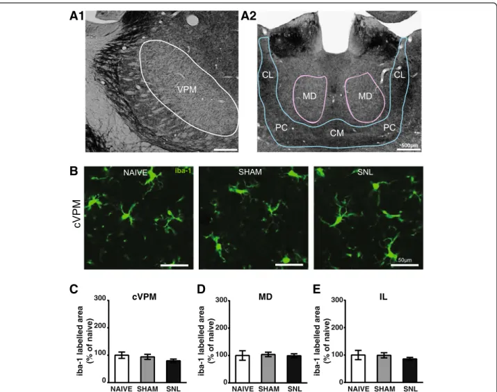 Fig. 7 Unaltered iba-1 immunostaining in the contralateral VPM (cVPM) and MD and intralaminar thalamic nuclei (IL) 14 days after spinal nerve ligation