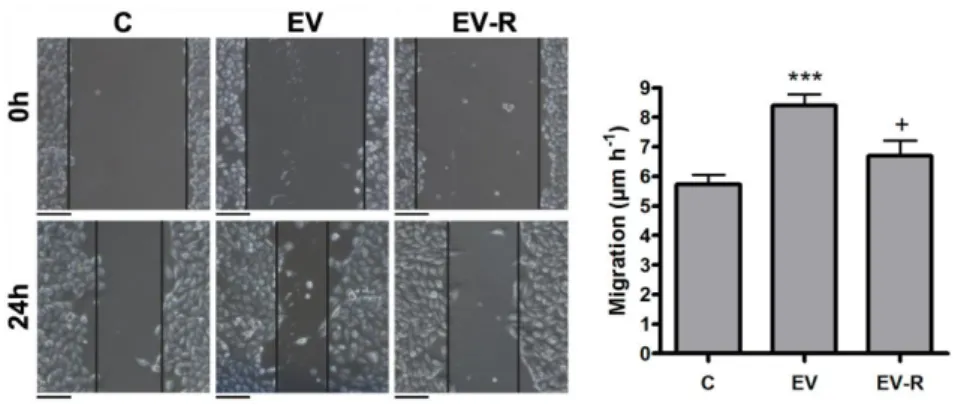 Figure 3. Reg3β blockage of THP-1 EV prevents their stimulatory role on MIAPaCa-2 cell migration