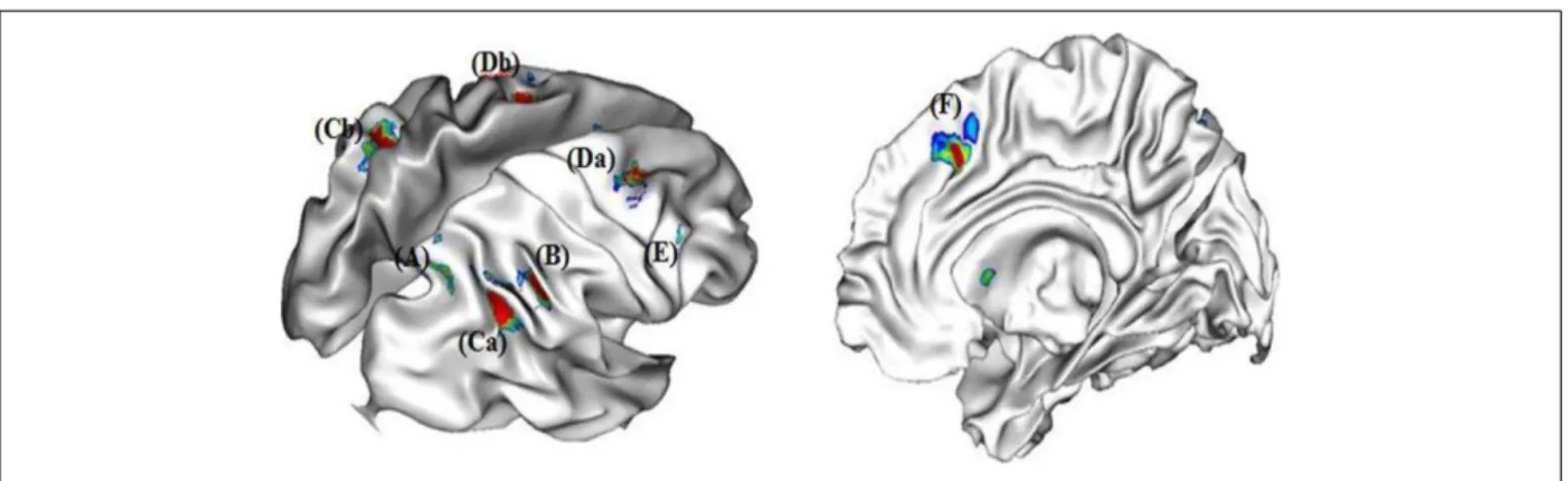 FIGURE 2 | Neural correlates of strategy selection (A) right precuneus, (B) right angular gyrus, (Ca) right and (Cb) left supramarginal gryi, (Da) right and (Db) left middle frontal gyri, (E) right dorso-lateral prefrontal cortex (DLPFC), and (F) right ant