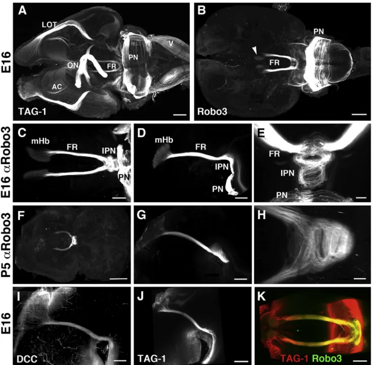 Figure 2. Robo3 Labeling and 3DISCO Clearing Is a Unique Tool to Study the Development of the Fasciculus Retroflexus