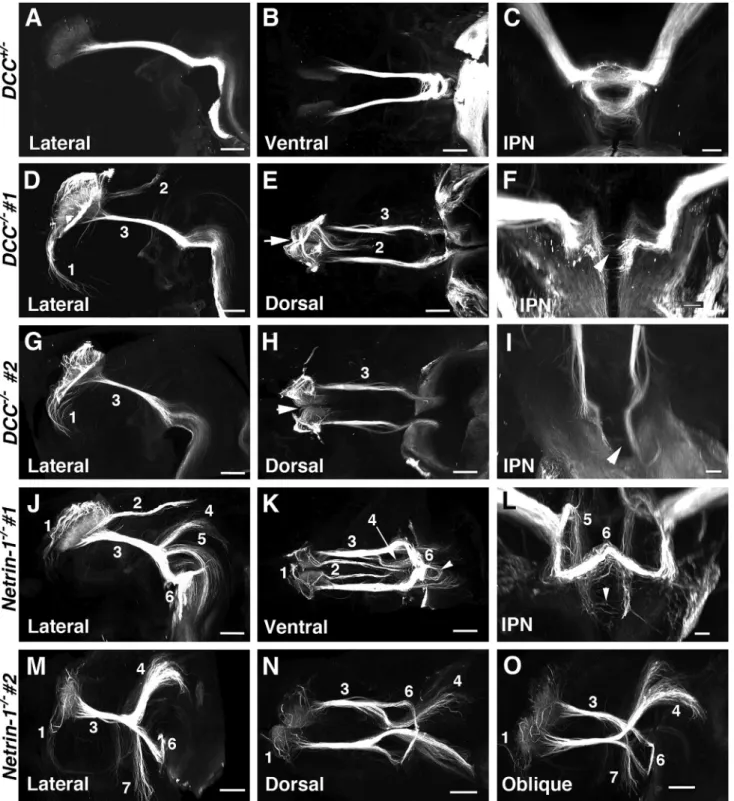 Figure 3. Diversity of FR Axon Guidance Defects in Netrin-1 and DCC Knockouts