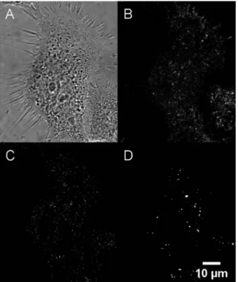 Fig. 7 Confocal imaging of live A431 cells incubated with NE[D2]. (A) Bright- ﬁ eld. (B) Fluorescence imaging (l exc ¼ 561 nm)