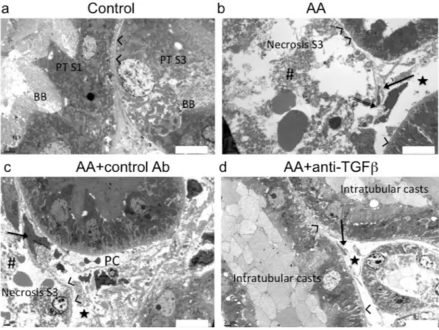 Fig 5. Anti-transforming growth factor beta (TGF β ) Ab attenuated aristolochic acid (AA)-induced ultrastructural alterations within the tubulointerstitial compartment
