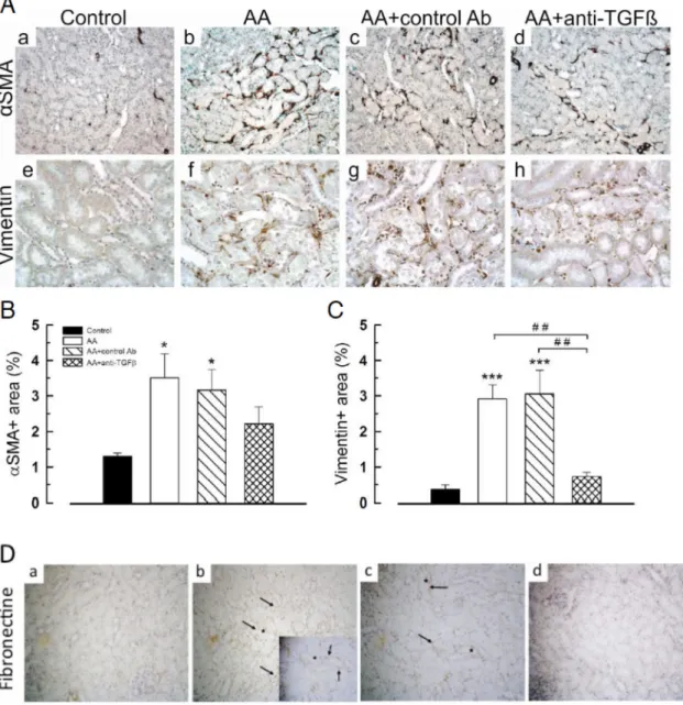 Fig 6. Anti-transforming growth factor beta (TGF β ) Ab modulated accumulation of mesenchymal cells and increase in fibronectin in tubulointerstitial compartment induced by aristolochic acid (AA)