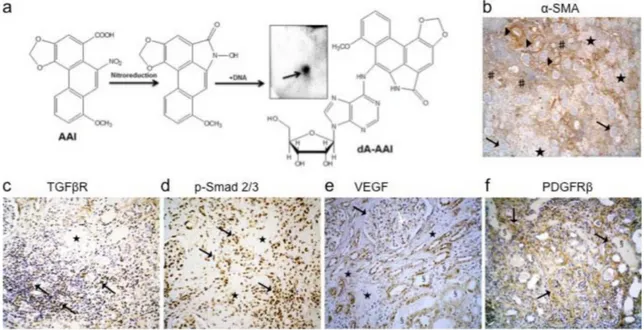 Fig 1. Representative histological findings in a human case of end-stage aristolochic acid nephropathy (AAN)