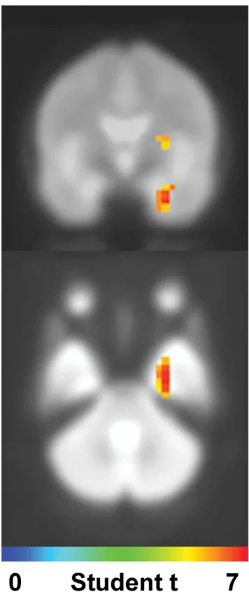 Figure 2. Time courses of activities at the right amygdala site.