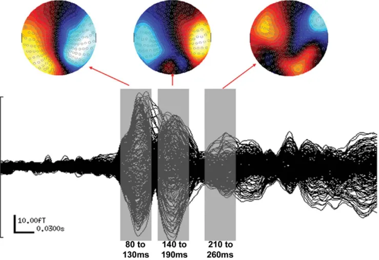 Figure 4. Sensor responses averaged across subjects and conditions. Event-related beamformer source analyses were performed in three 50 ms time windows (grey) surrounding the three major peaks