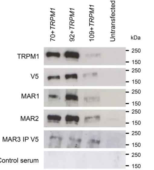 Fig 3. Western blot analysis of TRPM1 isoforms with MAR sera.