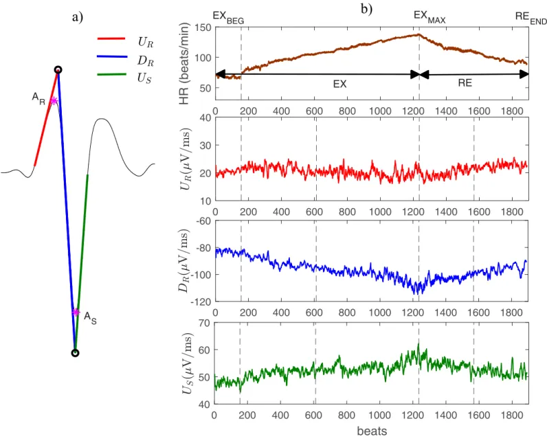 Fig 1. A) Example of a QRS complex and the three QRS slopes analyzed in this study (red, blue and green lines)