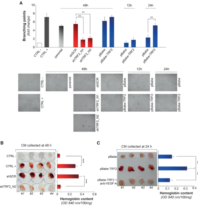 Figure 2. TRF2 modulation affects the secretome of tumor cells and the angiogenic response of endothelial cells