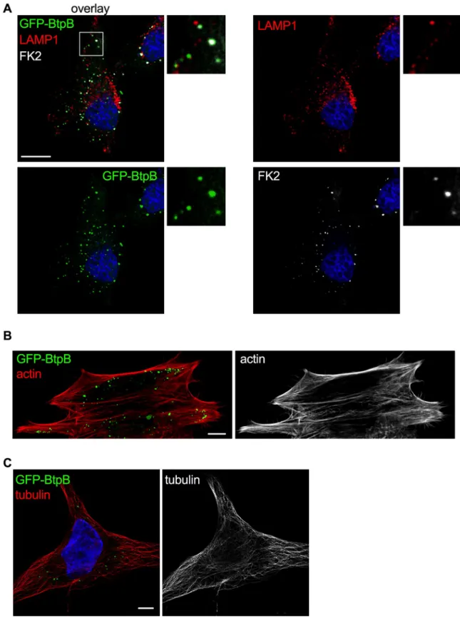 Fig 5. Localization of ectopically expressed BtpB in human cells. HeLa cells expressing GFP-BtpB (green) were labelled and analyzed by confocal immunofluorescence microscopy