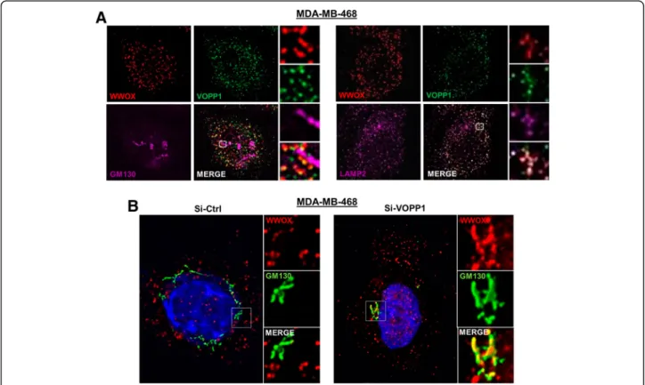 Fig. 3 Depletion of VOPP1 induces subcellular relocalization of WWOX from the lysosomes to the Golgi apparatus