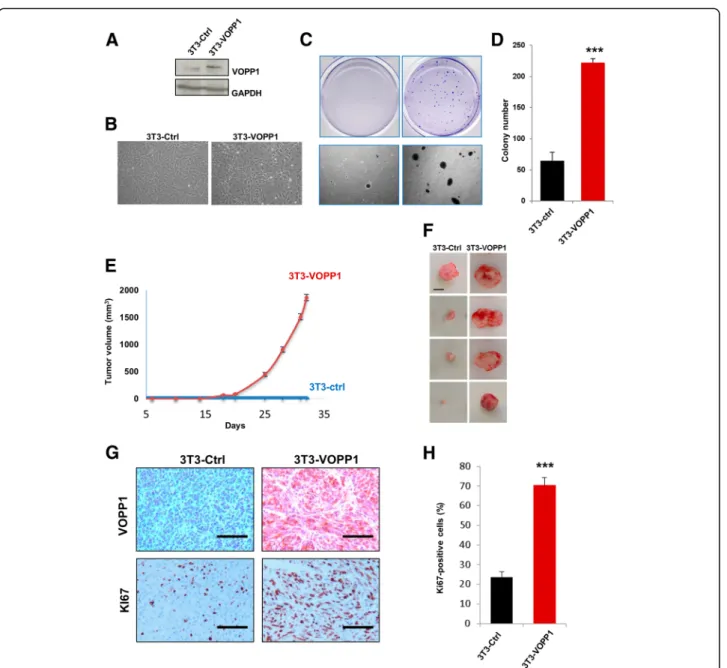 Fig. 5 VOPP1 induces cell transformation in vitro and tumorigenesis in vivo. a NIH3T3 cells were stably transfected with control VOPP1-expressing vectors