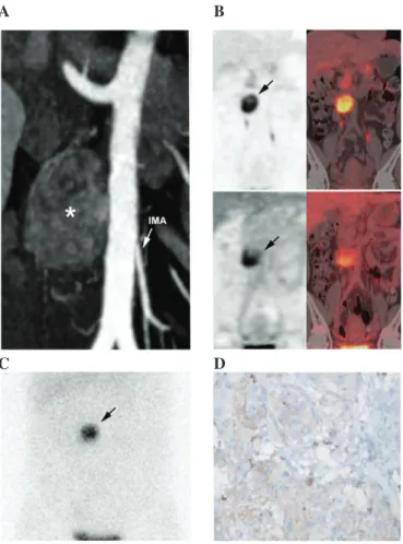 Figure 1. Imaging and pathological features of the OZ-PGL. 
