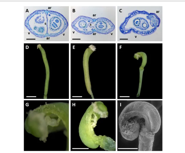 FIGURE 2 | Gynoecium morphology of A. thaliana aux1-22 mutants transformed with miR164-resistant (CUC2g-m4) or un-mutated control (CUC2g-wt) constructs