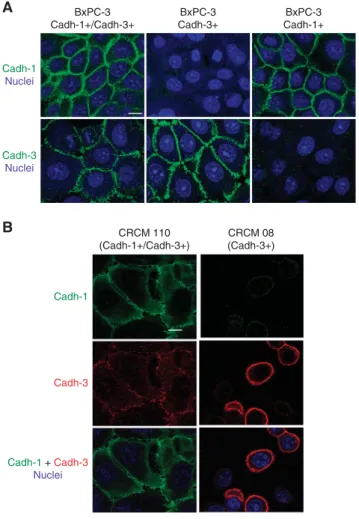 Figure 3. Cadherin expression in BxPC-3 cell models and in primary cultures from human tumours