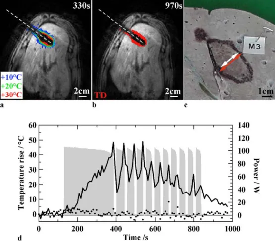 Fig. 2 Typical results of a RF ablation in pig liver. (a)  Gray-scale magnitude image obtained 330 s after the beginning of RF ablation, with superimposed temperature increases indicated with color code levels (blue corresponds to +10°C, green to +20°C and