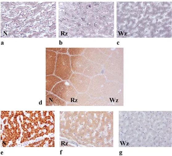 Fig. 4 Reticulin network stain- stain-ing in the normal liver (a), in the red zone (b) and in the white zone (c): the extracellular matrix is gradually altered in the Rz and Wz