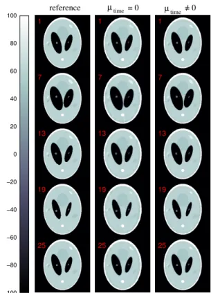 Fig. 6. 2D+t reconstructions (25 frames) of the dynamic Shepp-Logan phantom (values are given in Hounsfield units)