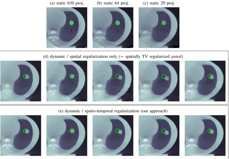 Fig. 9. 2D+t reconstructions of the median transversal slice of the mechanical phantom