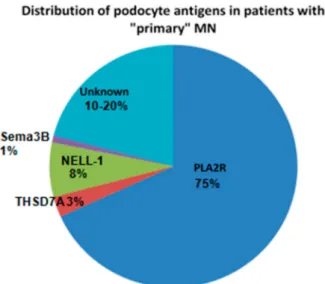Figure 3. Distribution of podocyte antigens in patients with “primary” membranous nephropa- nephropa-thy (MN).