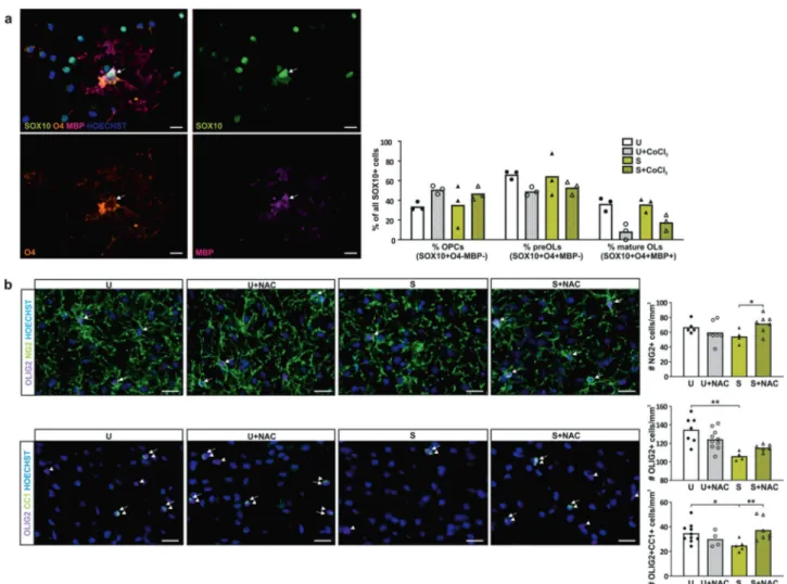 Fig. 4 NAC treatment rescues OL lineage progression in APO-SUS mPFC. a Representative image and quanti ﬁ cation of the percentages of all SOX10 + oligodendroglia cells that are OPC (SOX10 + O4-MBP − ), premyelinating OL (preOL) (SOX10 + O4 + MBP − ) and ma
