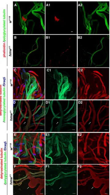 FIGURE 9:  hmw is required for sperm individualization and tubulin  modification in Drosophila testis