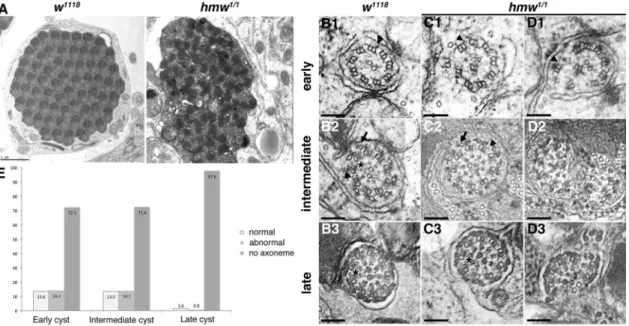 FIGURE 7:  hmw is involved in flagellar axoneme integrity. (A) Electron microscopy imaging of transverse sections of  control or hmw 1/1  spermatid cysts at late stages of spermatid maturation