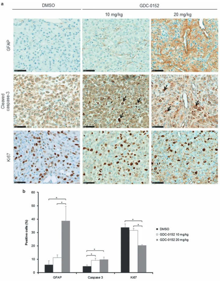 Figure 5 Immunohistochemistry analysis of mice-treated brains. (a) Representative GFAP, cleaved caspase-3 and Ki67 stainings of tumors treated with DMSO and 10 and 20 mg/kg of GDC-0152