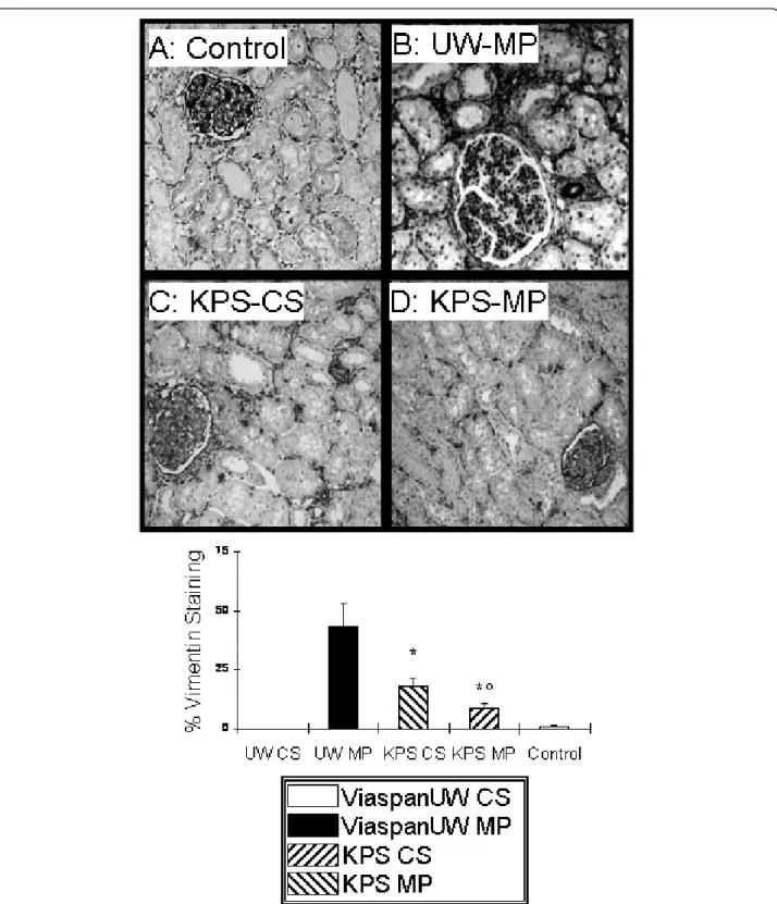 Figure 5 EMT development. A, B, C and D: Representative staining for Vimentin at 3 months