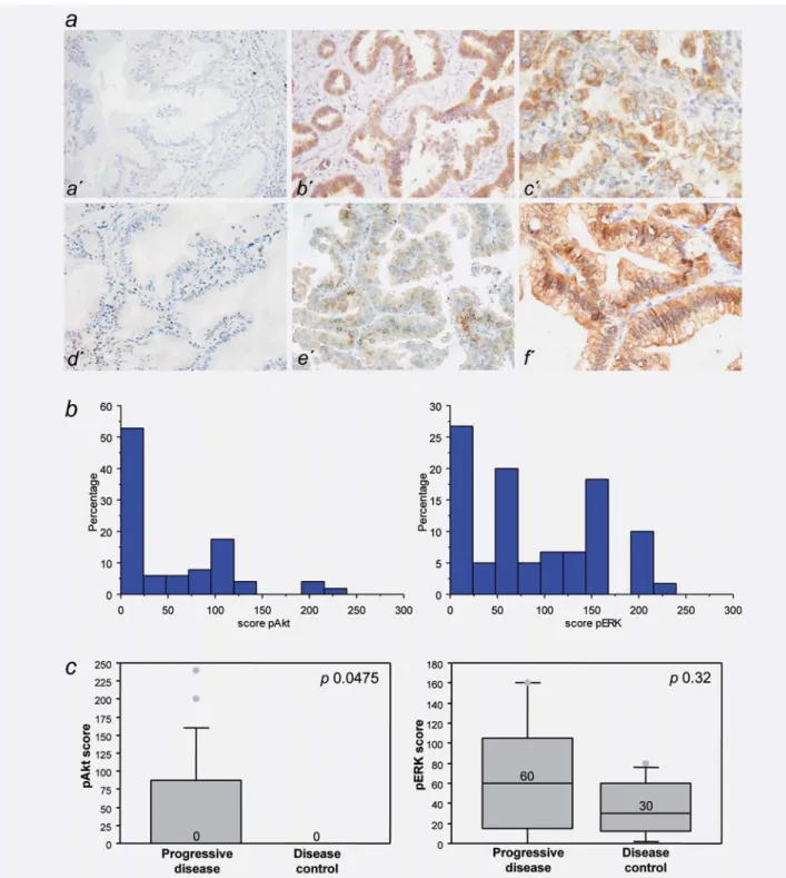 Figure 1. p-AKT and p-ERK1/2 immunostaining in NSCLC tumors. (a) Immunohistochemistry showing p-AKT expression (a, negative score, b, score of 100, c, score of 240) and p-ERK1/2 expression (d, negative score, e, score of 60, f, score of 160)
