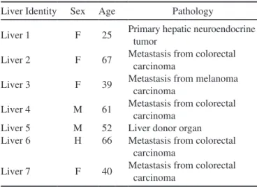 Table 1.  Characteristics of the Human Liver Donors