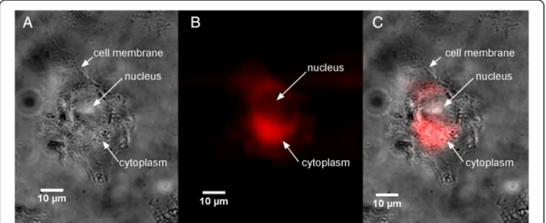 Figure 2 Localisation of GdBNs in U87 cells visualised by SR-DUV microscopy. (A) Light transmission image of U87 cell, (B) fluorescence image of label free GdBN (red), (C) merge of transmission and fluorescence images (GdBN in red).