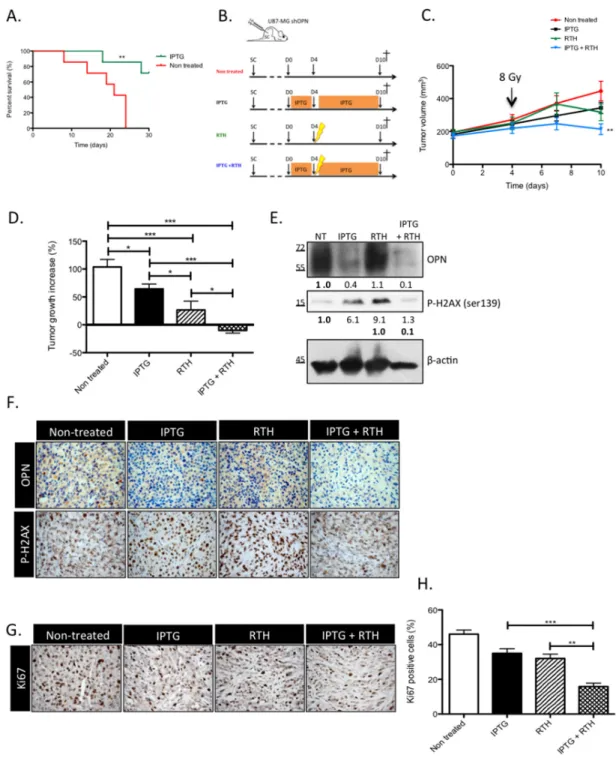 Figure 5: OPN knockdown improves the survival of GBM-bearing mice and induces a tumor shrinking when combined  to radiotherapy by decreasing the response to irradiation