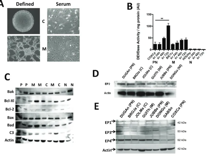 Figure 2: Characteristics of primary cultures derived from GBM patients.  Pictograph of primary cultures grown in defined  (left) and serum-supplemented (right) media