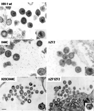 Table 2: Quantitative analysis of virus core morphology of NC mutant HIV-1 particles produced by HeLaP4 cells