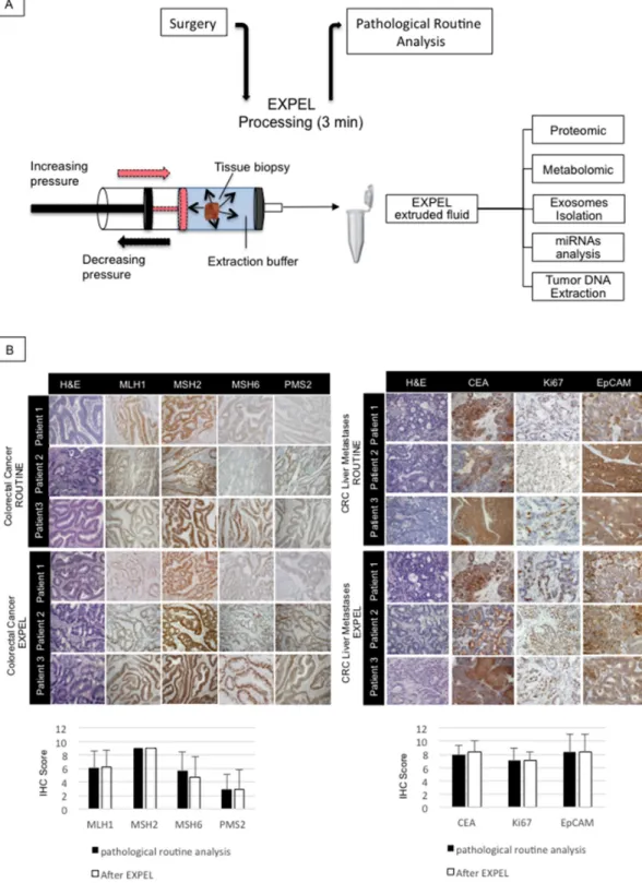 Figure 1: EXPEL method does not alter tissue morphology and antigenicity.  (A) Schematic overview of EXPEL workflow