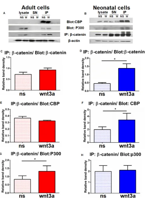 Figure 6. β-catenin, CBP and p300 immunoblots from β-catenin immunoprecipitates. Protein extracts from  non-stimulated (NS) of Wnt 3a stimulated neonatal (right panels) and adult (left panels) CD8+ T cells were 
