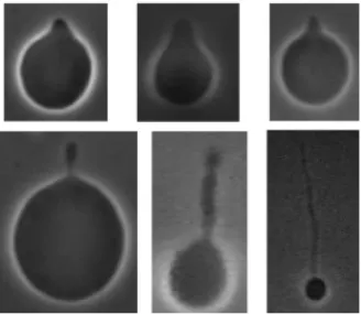 Figure 2 Typical stationary vesicle shapes. Top, pear-like shapes: (1.2) Radius 26 µm, (14.2) Radius  13  µ m, (6.2) Radius 32  µ m ;  bottom, vesicles with tubes: (11.1) Radius 30  µ m, (13.1) Radius 16  µ m ;  Radius 16 µm 
