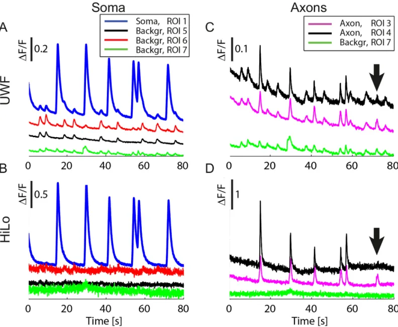 Fig 4. Suppression of non-specific signals. Nonspecific signals appeared in UWF mode (A, C) and were suppressed in HiLo mode (B, D) (ROIs numbered as in Fig 3A)