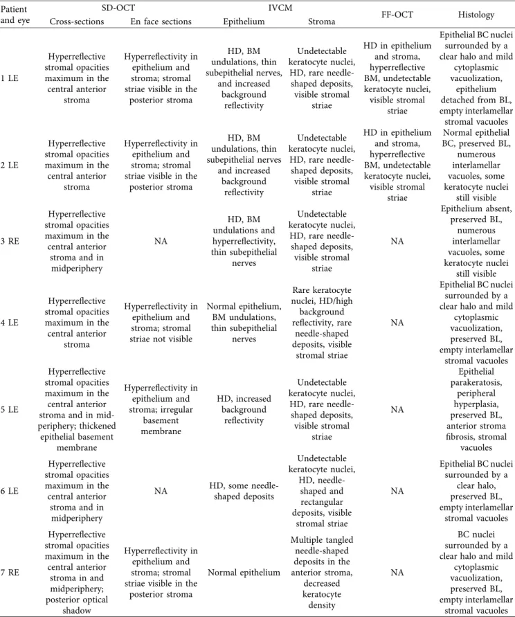 Table 2: Spectral domain optical coherence tomography (SD-OCT), in vivo confocal microscopy (IVCM), full-ﬁeld optical coherence tomography (FF-OCT), and histology ﬁndings of seven eyes of seven patients with Schnyder corneal dystrophy.