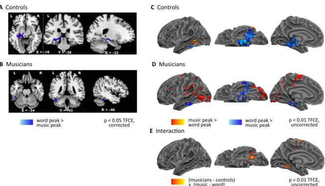 Fig. 3. Effects of musical expertise on the connectivity of word and music peaks. (A–B) Comparison of music and word tracts in controls (A) and in musicians (B), at a voxelwise threshold of p &lt; 0.05 TFCE FWE corrected, showing an advantage for words ove